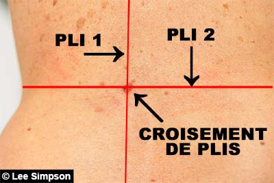 Plis qui causent la tache brune